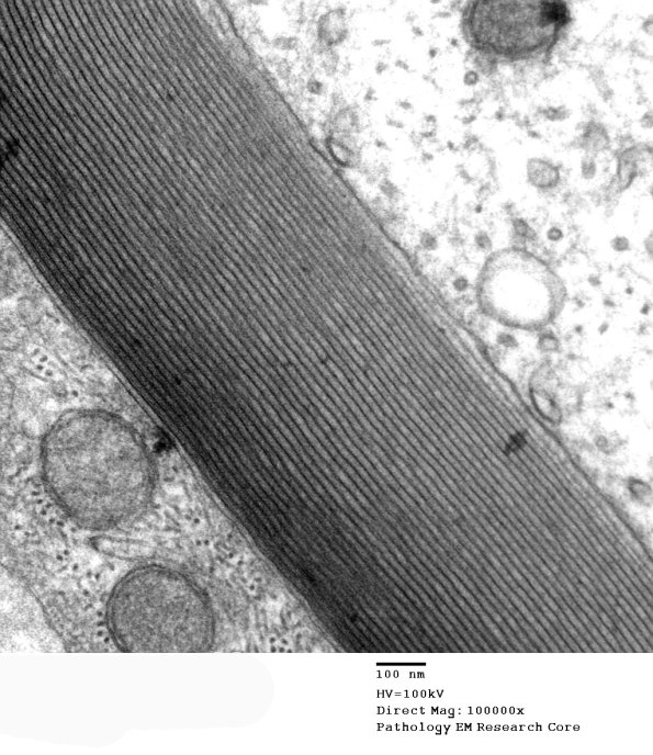5B4 Two Tone Myelin (Case 5)_009 - Copy