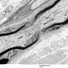 10A4 Node of Ranvier, Diabetic NP (Case 2) EM 054 - Copy