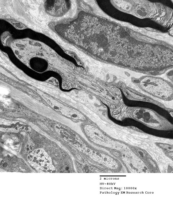 11A1 Normal Node of Ranvier (Case 9) EM A_178 - Copy