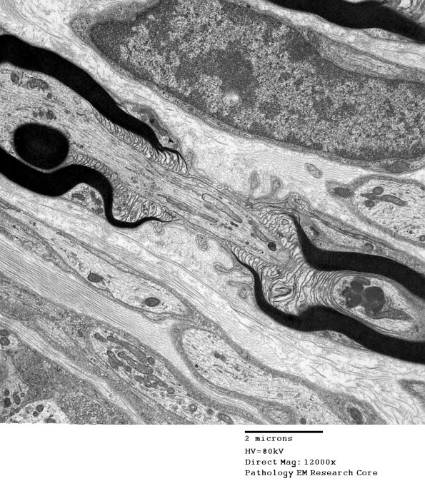 11A2 Normal Node of Ranvier (Case 9) EM A_168 - Copy
