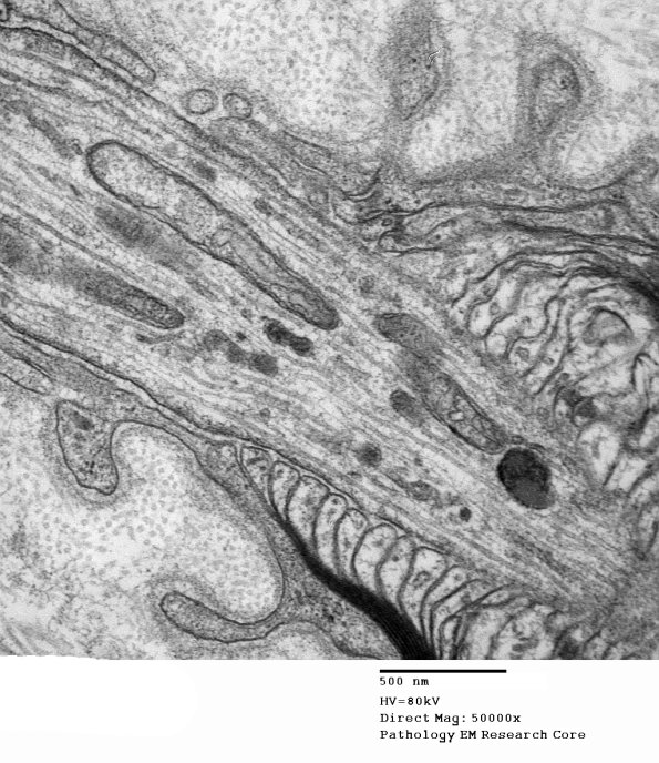 11A4 Normal Node of Ranvier (Case 9) EM A_171 - Copy