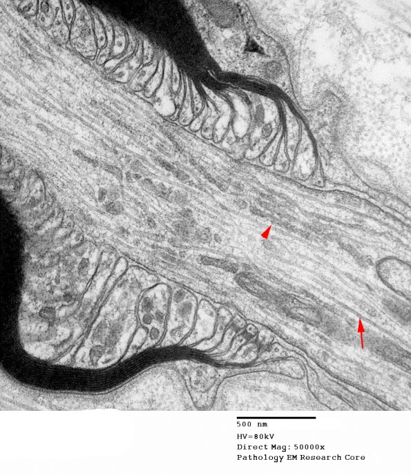 11A5 Normal Node of Ranvier (Case 9) EM A_170 copy.jpg