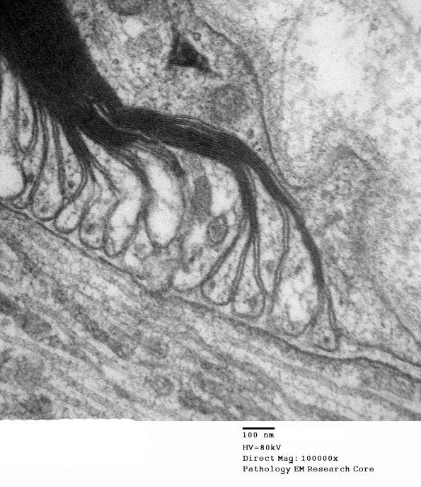 11A6 Normal Node of Ranvier (Case 9) EM A_172 - Copy