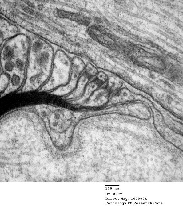 11A7 Normal Node of Ranvier (Case 9) EM A_173 - Copy