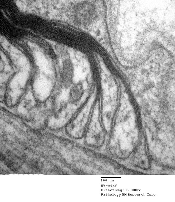 11A9 Normal Node of Ranvier (Case 9) EM A_176 - Copy