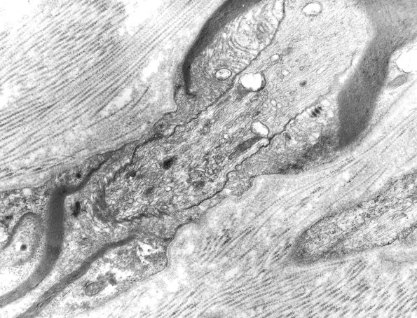 16A Normal nerve, Node of Ranvier EM 1 - Copy