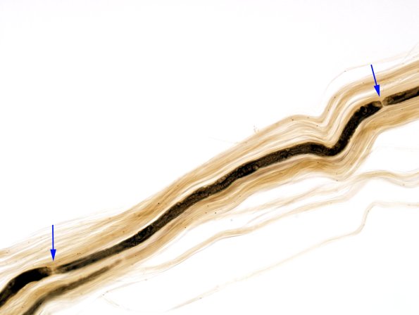 1A1 Normal teased (RES) copy