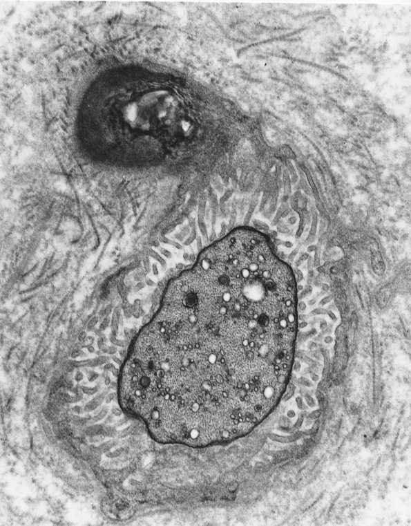3A1 Node of Ranvier - Copy