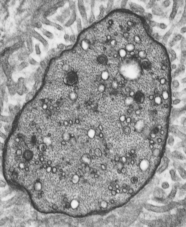 3A2 Closeup of Node of Ranvier - Copy