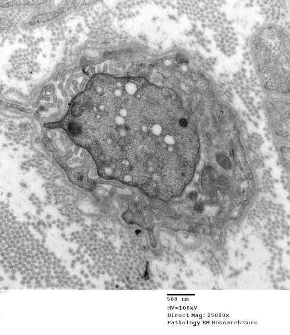 4A1 Case 3 EM 009 - Copy