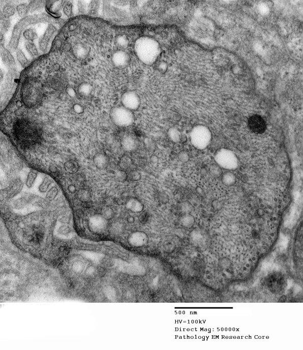 4A2 Case 3 EM 010 - Copy