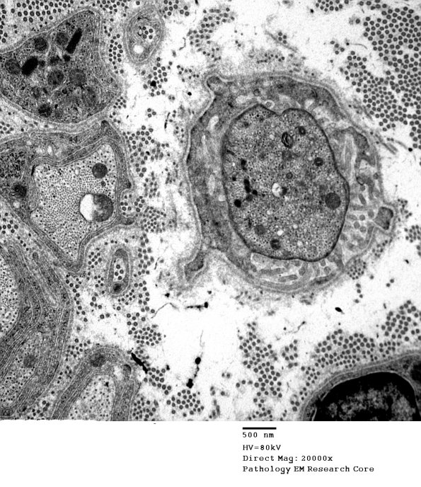 6A1 Node Ranvier, normal axon, sural (Case 5) EM 008 - Copy