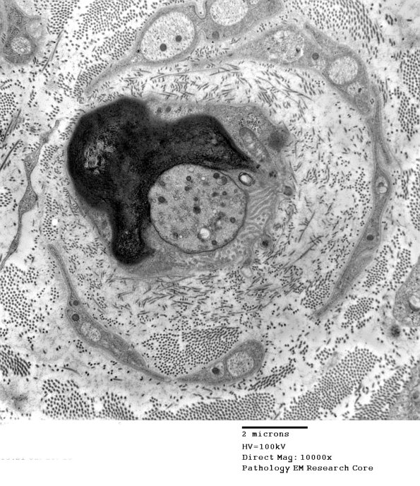 7A1 Case 6 EM 021 - Copy