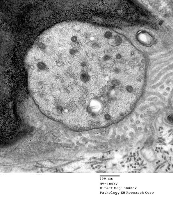 7A2 Case 6 EM 023 - Copy