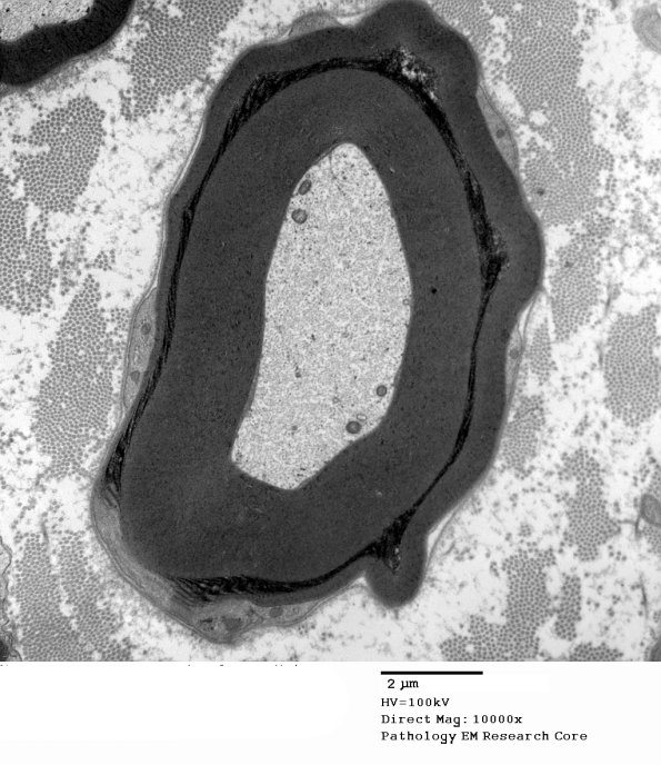 10A1 S-LC (Case 10) EM 147 - Copy