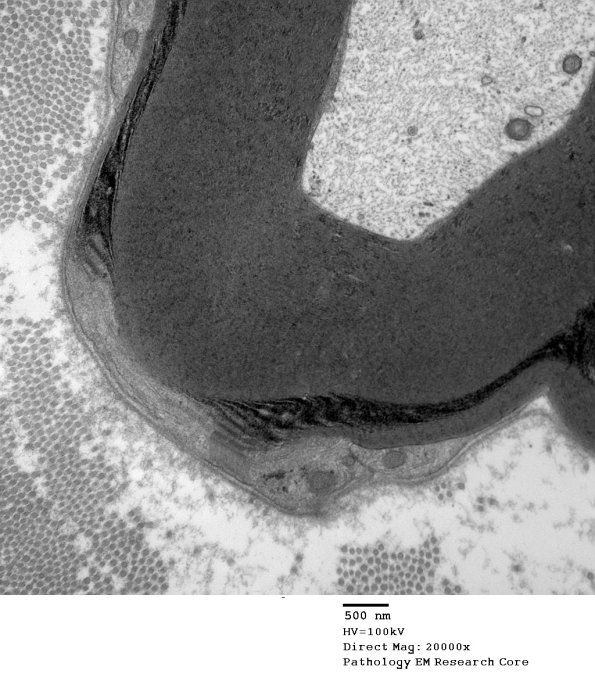 10A2 SLC (Case 10) EM 148 - Copy