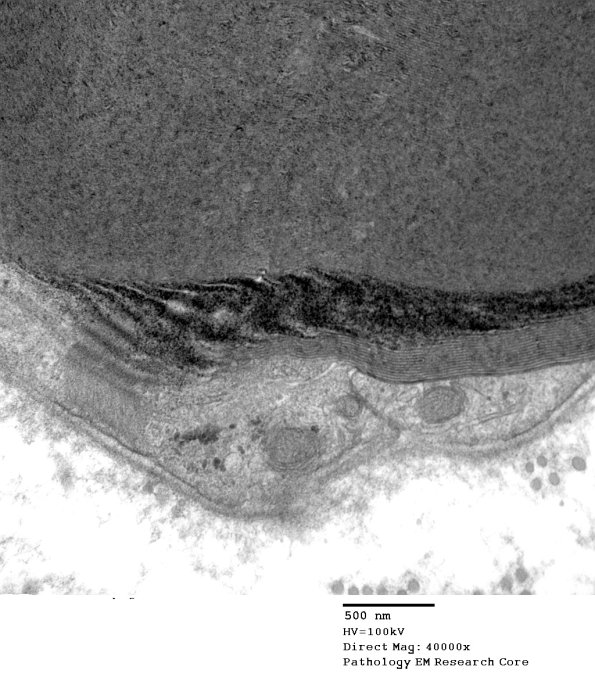 10A3 SLC (Case 10) EM 14M 149 - Copy