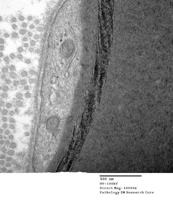 10A4 S-LC (Case 10) EM 151 - Copy