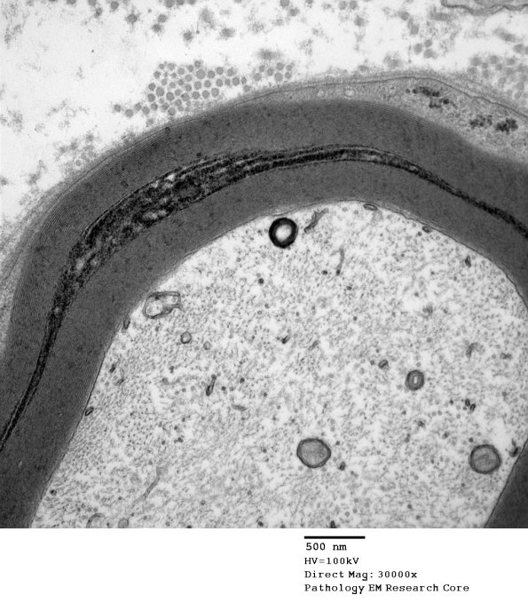 10B2 S-LC (Case 10) EM 155 - Copy