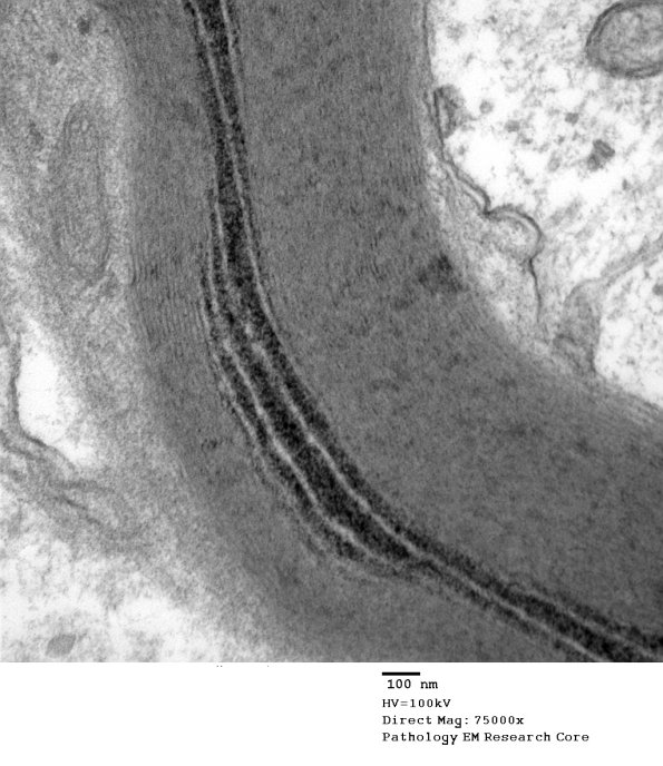 10B3 S-LC (Case 10) EM 157 - Copy