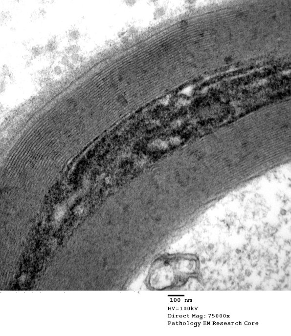 10B4 S-LC (Case 10) EM 158 - Copy