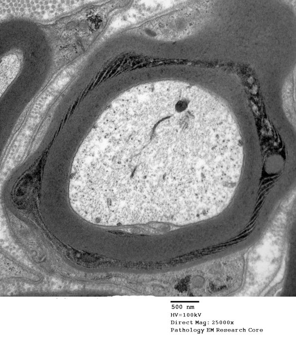 10C1 SLC (Case 10) EM 162 - Copy
