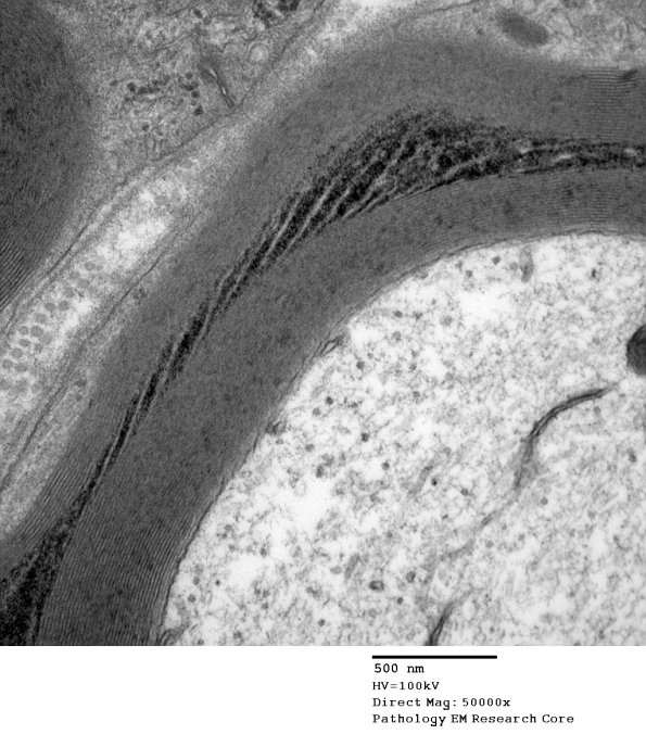 10C2 SLC (Case 10) EM 163 - Copy