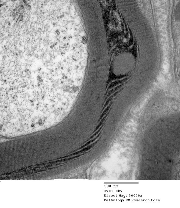 10C3 SLC (Case 10) EM 164 - Copy