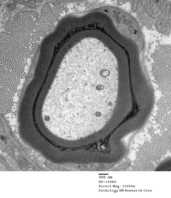 10D SLC (Case 10) EM 166 - Copy