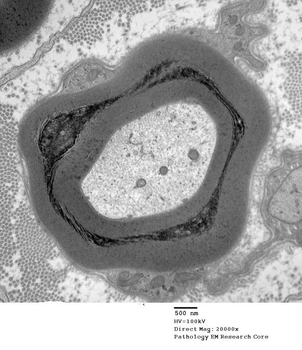 10E SLC (Case 10) EM 167 - Copy