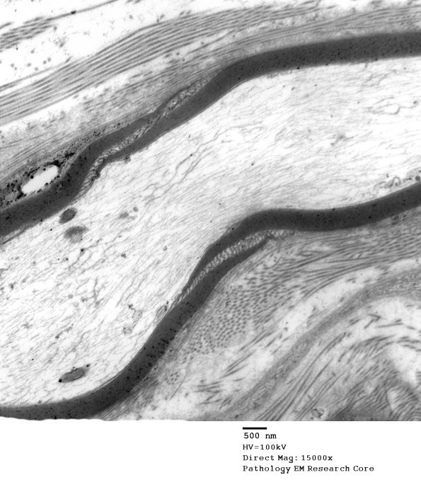 3B1 Diabetes longitudinal, SLC (Case 3) 014 - Copy