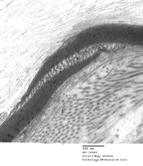 3B2 Diabetes longitudinal, SLC (Case 3) 015 - Copy