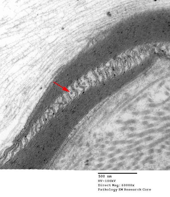 3B3 Diabetes longitudinal, SLC (Case 3) 016 - Copy copy