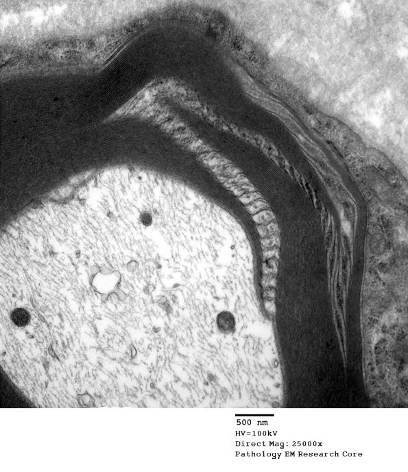 4A3 Schmidt-Lanterman clefts (Case 4)_0 - Copy