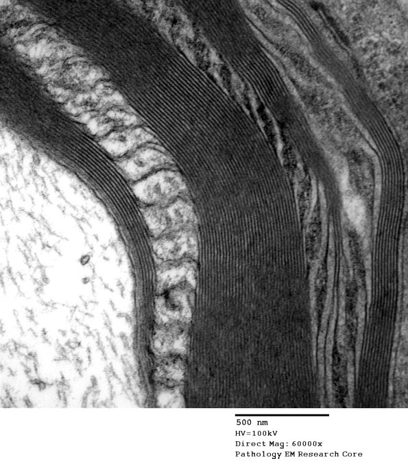 4A5 Schmidt-Lanterman (Case 4)_056 - Copy