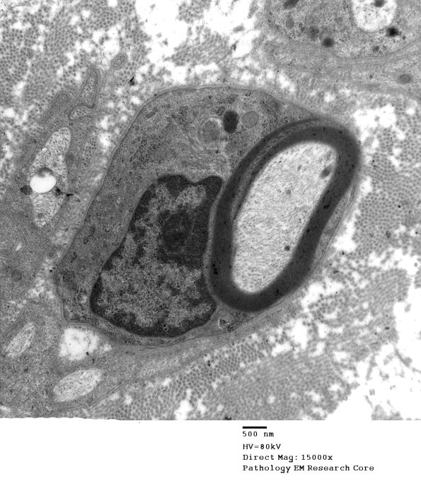 6A1 Normal nerve, Schmidt-Lanterman Cleft (Case 6) 002 - Copy
