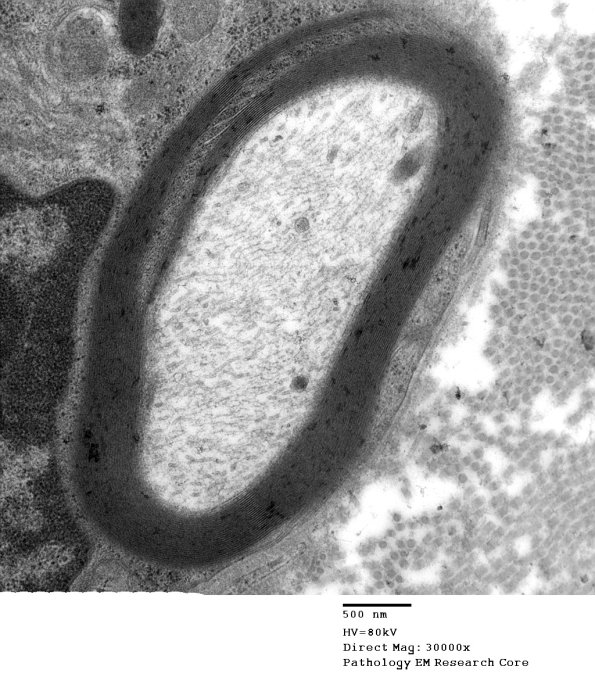 6A2 Normal nerve, Schmidt-Lanterman Cleft (Case 6) 003 - Copy