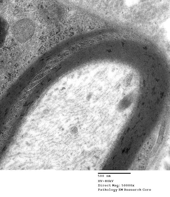 6A3 Normal nerve, Schmidt-Lanterman Cleft (Case 6) 004 - Copy