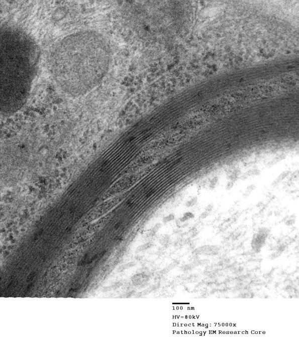 6A4 Normal nerve, Schmidt-Lanterman Cleft (Case 6) 005 - Copy