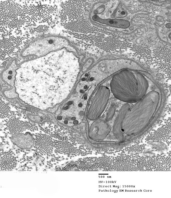 10A1 (Case 10) EM 032 - Copy