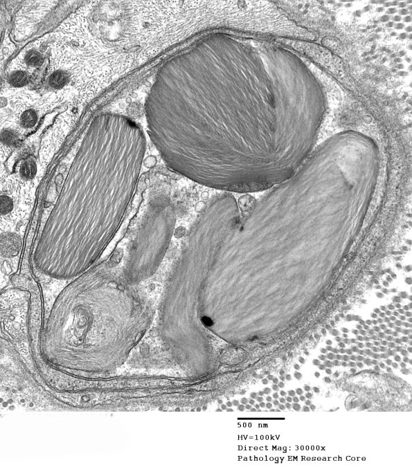 10A2 (Case 10) EM 033 - Copy