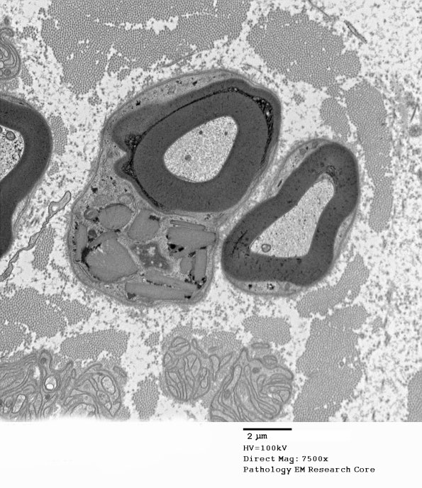 11A1 (Case 11) EM 123 - Copy