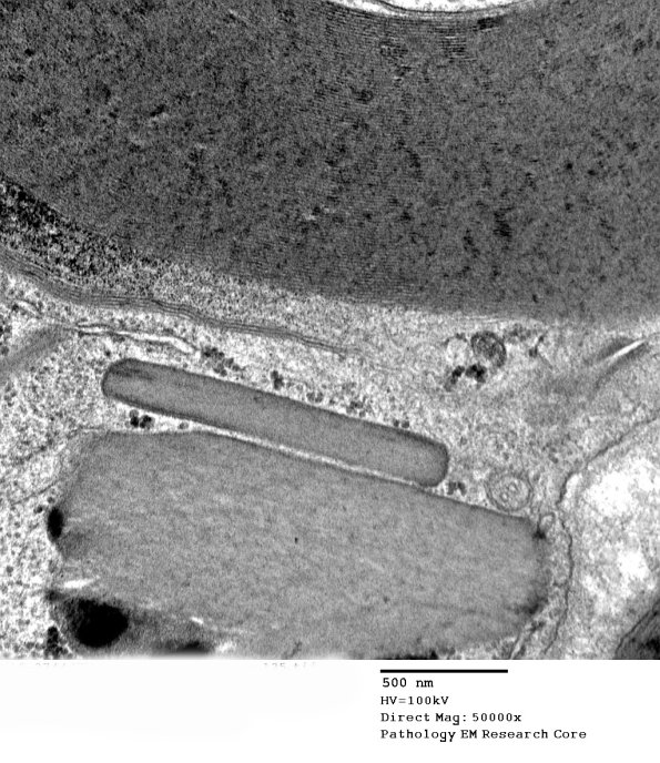 11A2 (Case 11) EM 125 - Copy