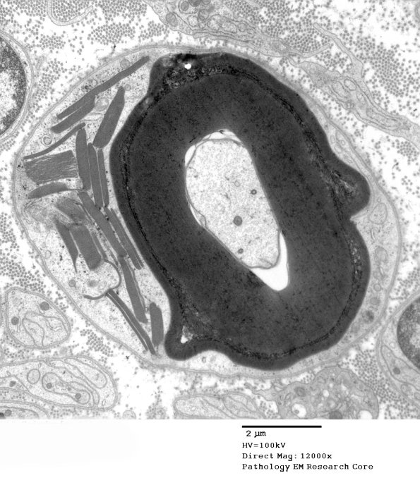 12A1 (Case 12) EM 015 - Copy