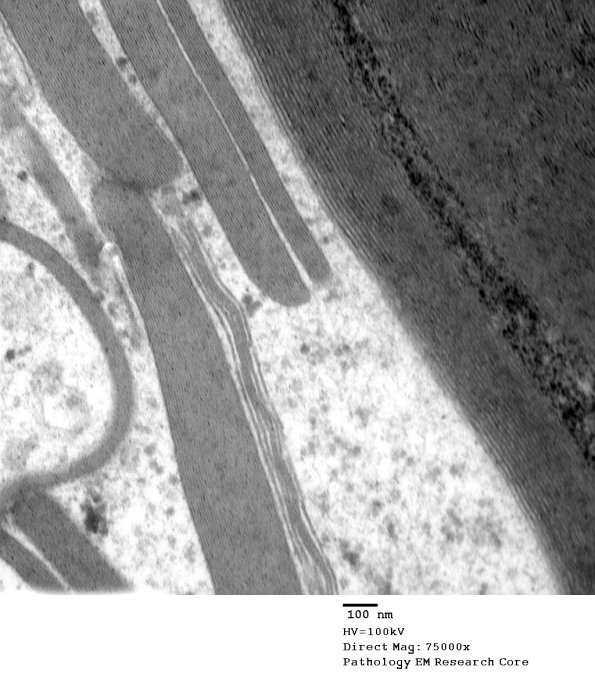 12A2 (Case 12) EM 012 - Copy