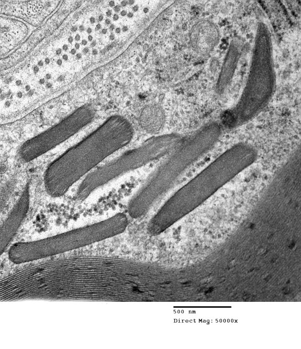 2A2 (Case 2) EM 018 - Copy