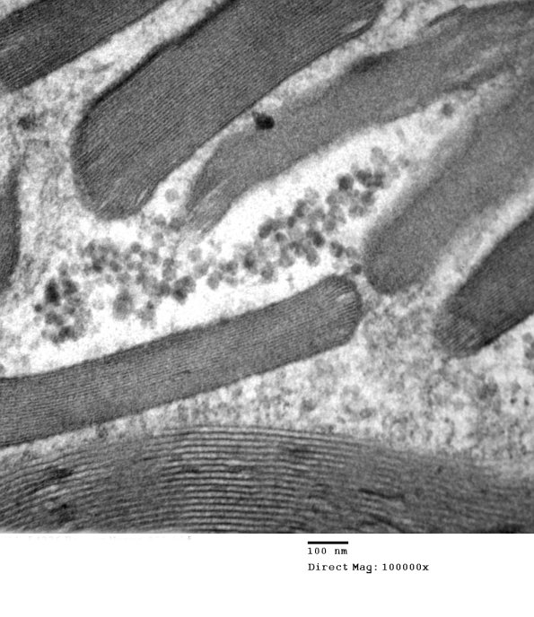2A4 (Case 2) Nerve_031 - Copy