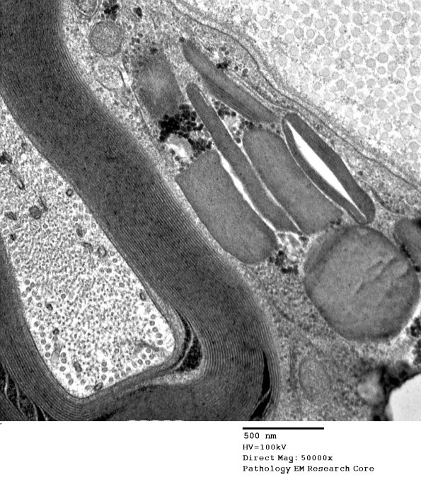 3A2 Pi Granules (Case 3) EM 043 - Copy