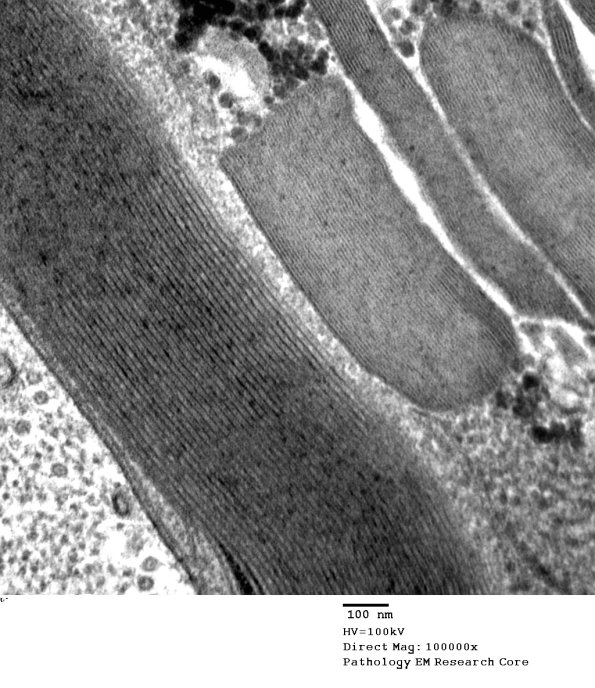 3A3 Pi Granules (Case 3) EM 046 - Copy