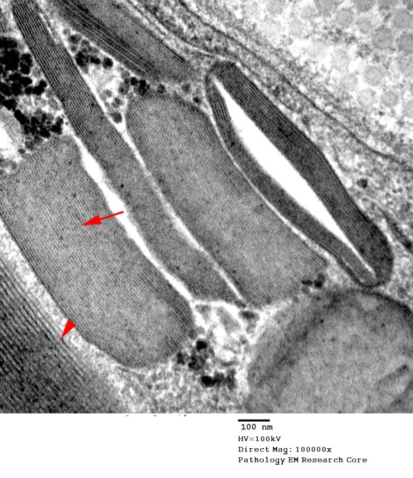 3A4 Pi Granules (Case 3) EM 048 copy.jpg